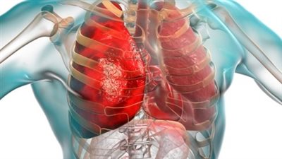 الالتهاب الرئوي.. أعراضه والوقاية منه ومراحل الخطورة