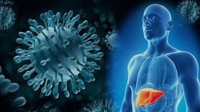 روشتة طبية للتعامل مع الفيروسات المعوية وأهم أعراضها.. فيديو